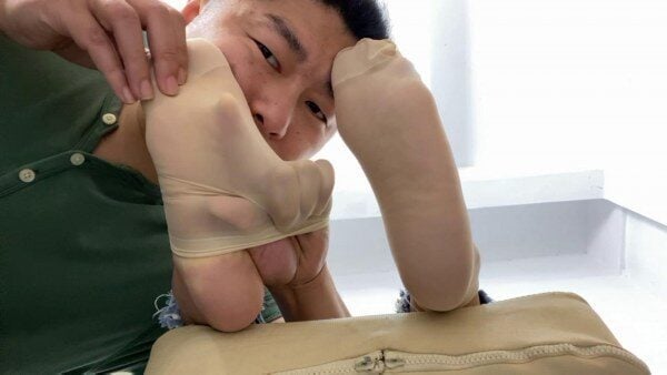 裸足フォーラム |元ミルクティーガールの肉片が剥がれたら奇跡が起きるでしょうか？