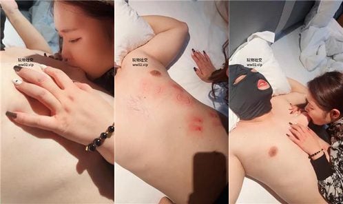 水凝 | 判处跑骚狗咬刑