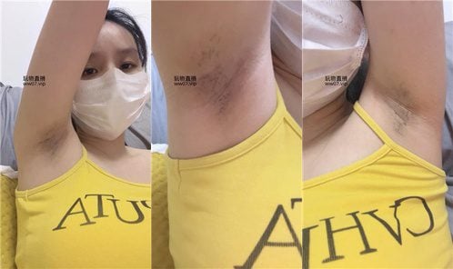 兔牙 | 这是你心心念念的腋下吗 250226-20