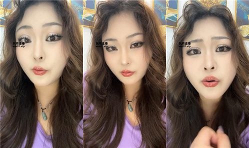 July | 乳母绿母 250422-4